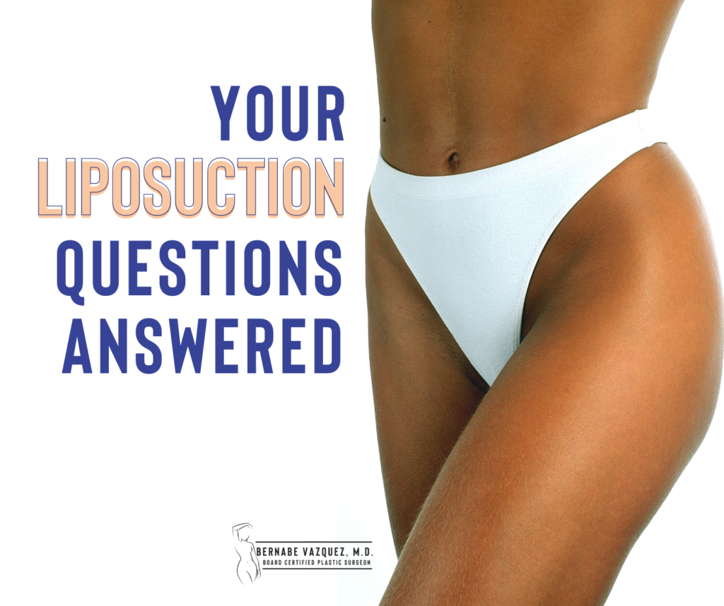 Your liposuction questions answered
