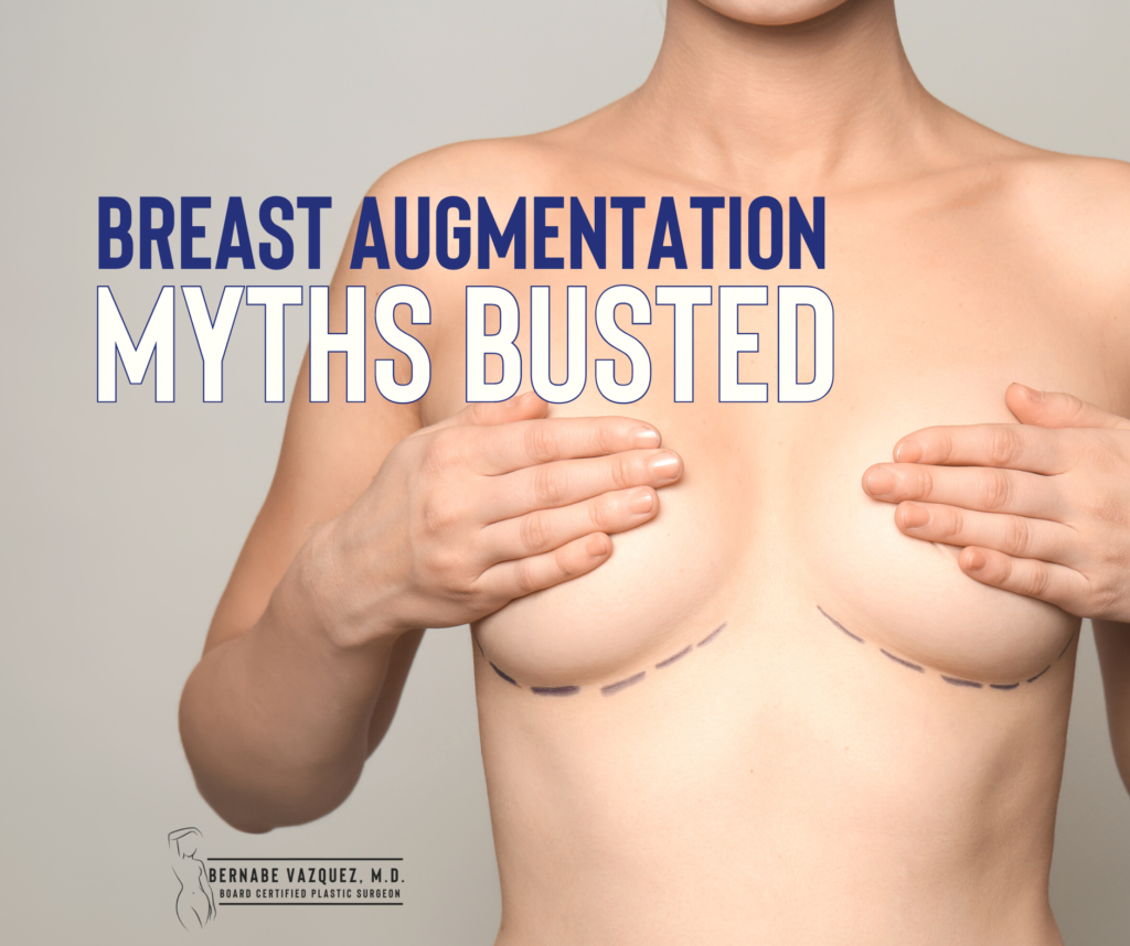 Breast augmentation myths busted